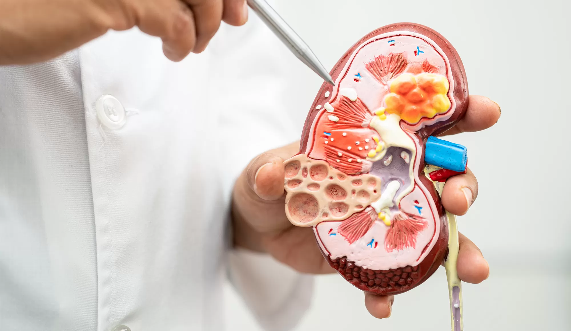 Natural Relief from Kidney Stones & Psoriasis – Trusted Healing at Dr. Mahadik’s Clinic, Bhor